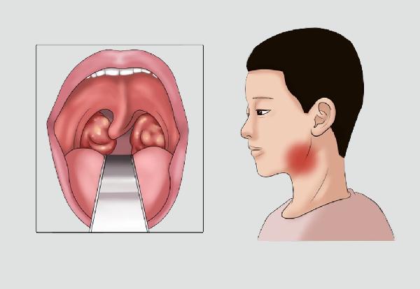 腐竹的做法过程大全家常介绍